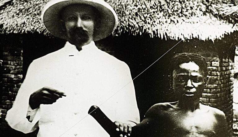king leopold with amputated victim