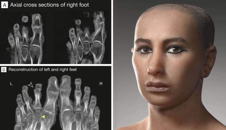 king tutankhamun facial reconstruction dna xrays
